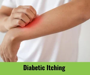 diabetic-itching